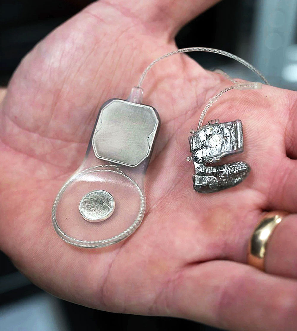 Unsw Bionic Eye Promising results for University of Sydney bionic eye - South Sydney Herald